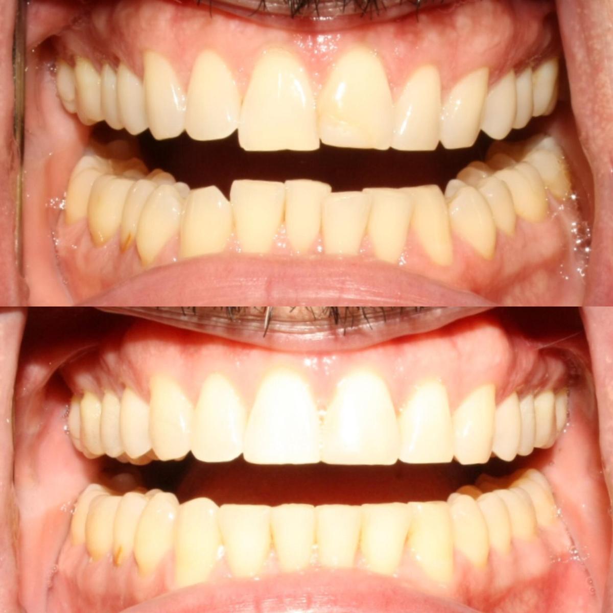 Upland Dental Implant and Orthodontics Cylex Local Search