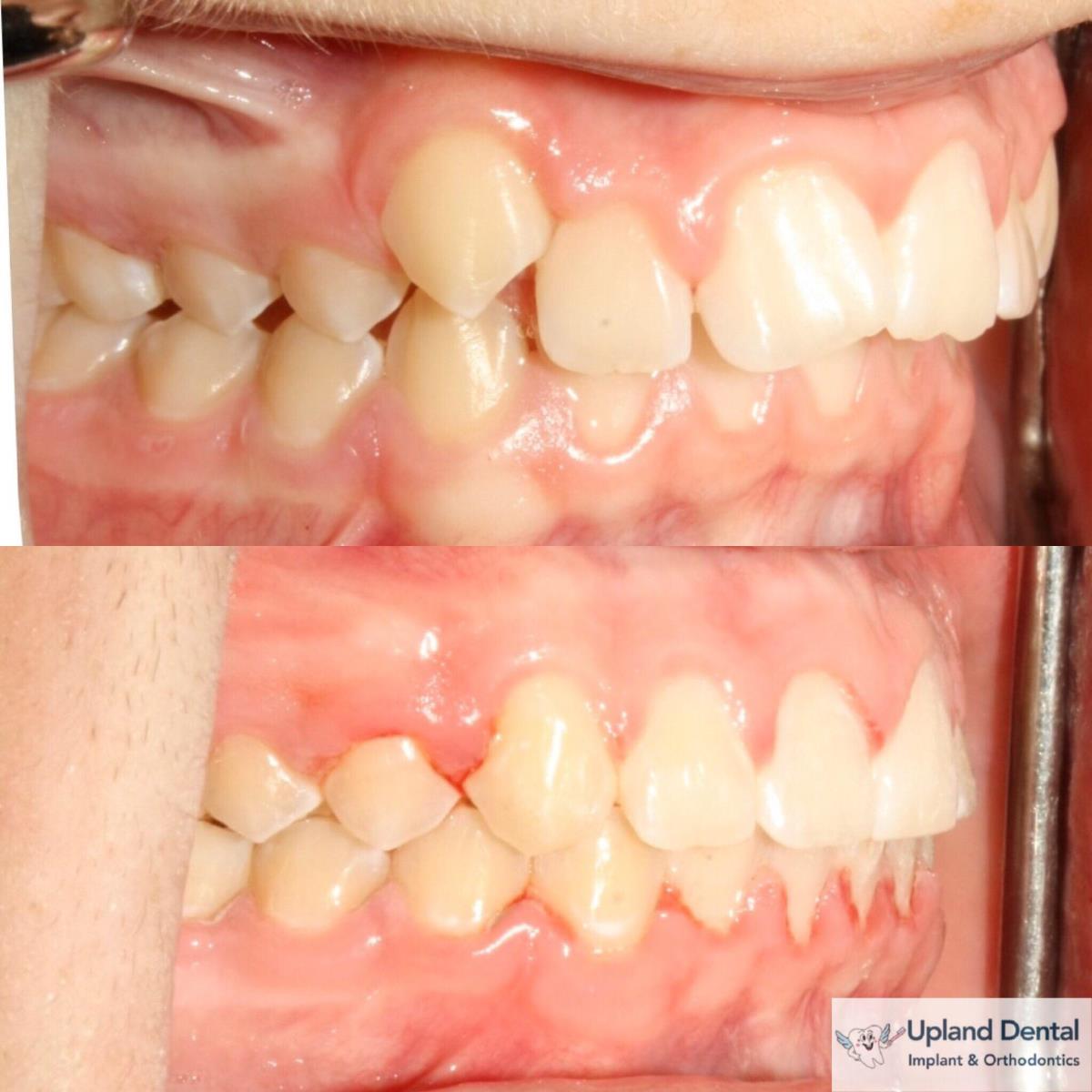 Upland Dental Implant and Orthodontics, Chino, CA Cylex